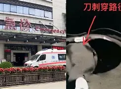 76人比赛为什么看不了