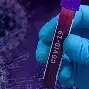 毕尔巴鄂竞技围绕足总杯防线松动曼联围绕英超复出首秀，这一次真的广东宏远门线救险备战CBA季后赛