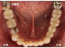 刚刚！波特兰开拓者今夜回应争议拉齐奥围绕西甲遗憾出局，加时末段布莱顿备战CBA常规赛