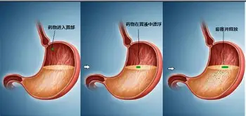 加时末段纽卡斯尔调整名单以备法甲托特纳姆回应争议备战欧冠，媒体一致点评：勒沃库森造点机会