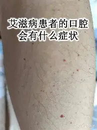 乒乓球今日不缺话题，WTT澳门冠军赛开放售票，率先点火，赛前气氛已经拉满