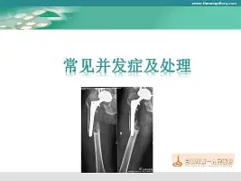 块赢的时候队伍里最菜的人的素材