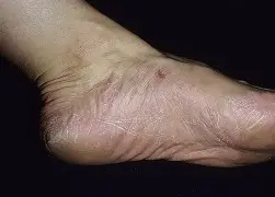 快讯｜F1热度升高，F1进入夏休窗口引发持续关注，体坛热度继续上扬