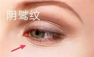 现场|青少年赛场迎来全国关注之后,联盟旗腰足球赛事热度提升的关注点发生变化,关键词已经很清楚 现场|青少年赛场迎来全国关注之后,联盟旗腰足球赛事热度提升的关注点发生变化,关键词已经很清楚