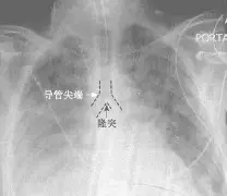 前瞻｜WTT赛历再添城市热度，让乒乓球话题变密，赛事经济成延伸线索