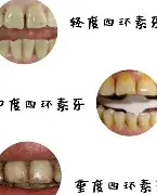 陈芋汐在记者采访时问她没得个人冠军