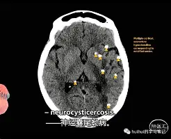 奥运会伟大教练效应