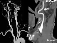 争议｜鲨鱼续约麦克林·塞莱布里尼，成为跨平台热词，建队核心正在接棒，赛前气氛已经拉满